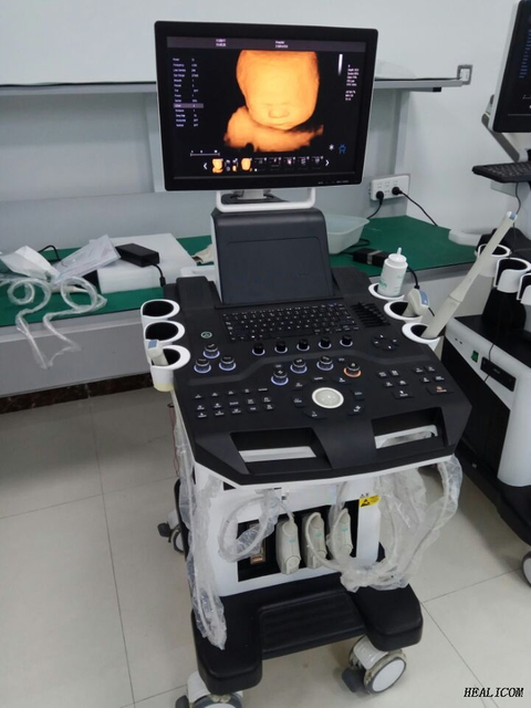 Équipement médical HUC-600P Chariot numérique complet type 4D Scanner à ultrasons Doppler couleur