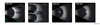 อุปกรณ์การแพทย์ HO-200 Ophthalmic A/B Ultrasound Scanner