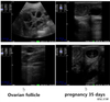 Equipamento de ultrassom de ultrassom de ultrassom portátil HV-1 para animais