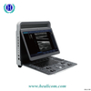 E1 Sonoscape Medical portátil Ultrasound Scanner preço da máquina de sonda de ultrassom preto e branco