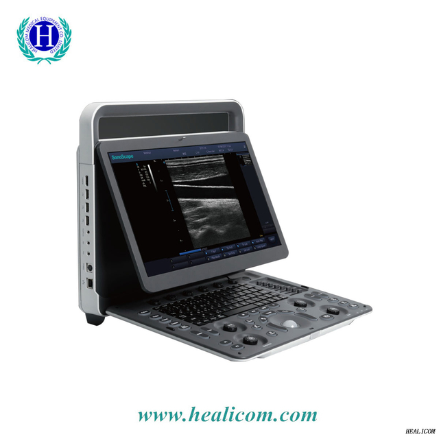 E1 Sonoscape Medical Portable Ultrasound Scanner System بالأبيض والأسود سعر آلة التحقيق بالموجات فوق الصوتية