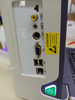 Scanner de ultrassom Doppler colorido portátil HUC-260 de alta qualidade