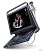 Sistema de diagnóstico HUC-590 Máquina de ultrassom digital portátil 3D 4D Doppler colorido Sistema de diagnóstico HUC-590 Máquina de ultrassom digital portátil 3D 4D Doppler colorido
