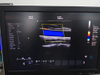 Equipamento médico HUC-600P Scanner de ultrassom Doppler colorido tipo 4D em carrinho digital completo