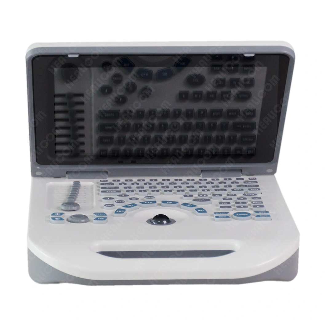 HBW-3 Plus Full Digital Laptop B/W Ultrasound Machine From China ...