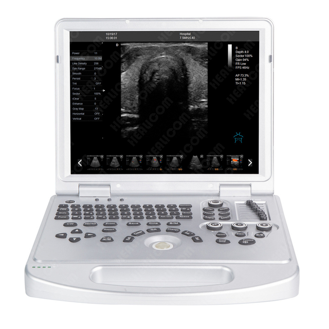 HUC-250PD Portable 3D 4D Laptop color doppler Ultrasound Machine