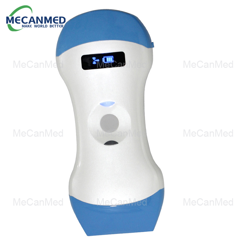 portable wifi ultrasound scanner
