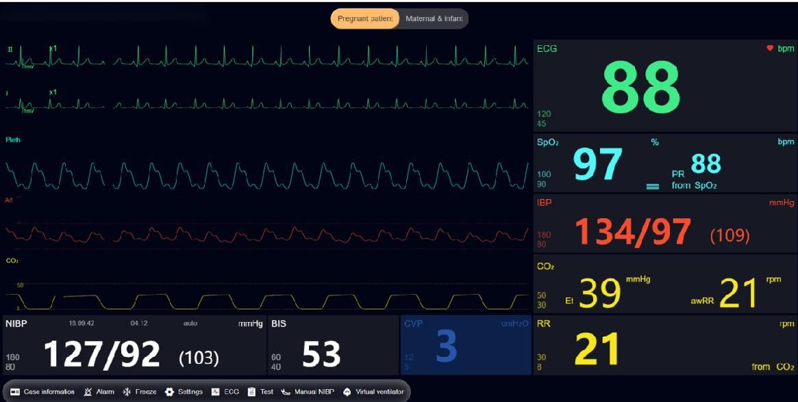 산부인과 훈련을 위한 실시간 동기화된 산모-태아 활력징후 모니터링을 보여주는 고급 분만 시뮬레이터