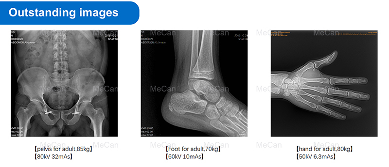 Excellentes images du d&eacute;tecteur &agrave; &eacute;cran plat pour l'homme