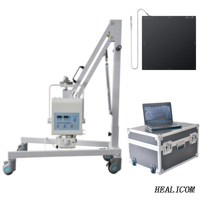 Máy dò tia phẳng kỹ thuật số WTX-04DR chất lượng cao Máy chụp X-quang kỹ thuật số hộp nhôm di động