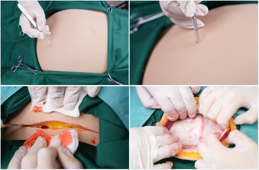 MCE0937 ماڊلر پيٽ جا حصا الٽراسائونڊ، palpation، ۽ سيزرين سموليشن لاءِ