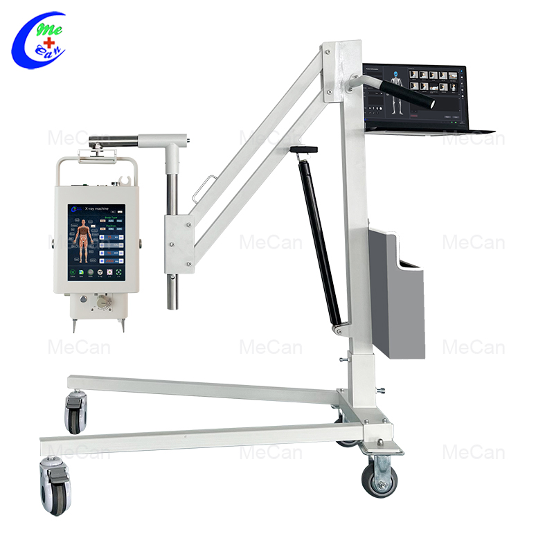 MX-DR056A12 5.6KW Radagrafa&iacute;ocht Dhigiteach Inaistrithe