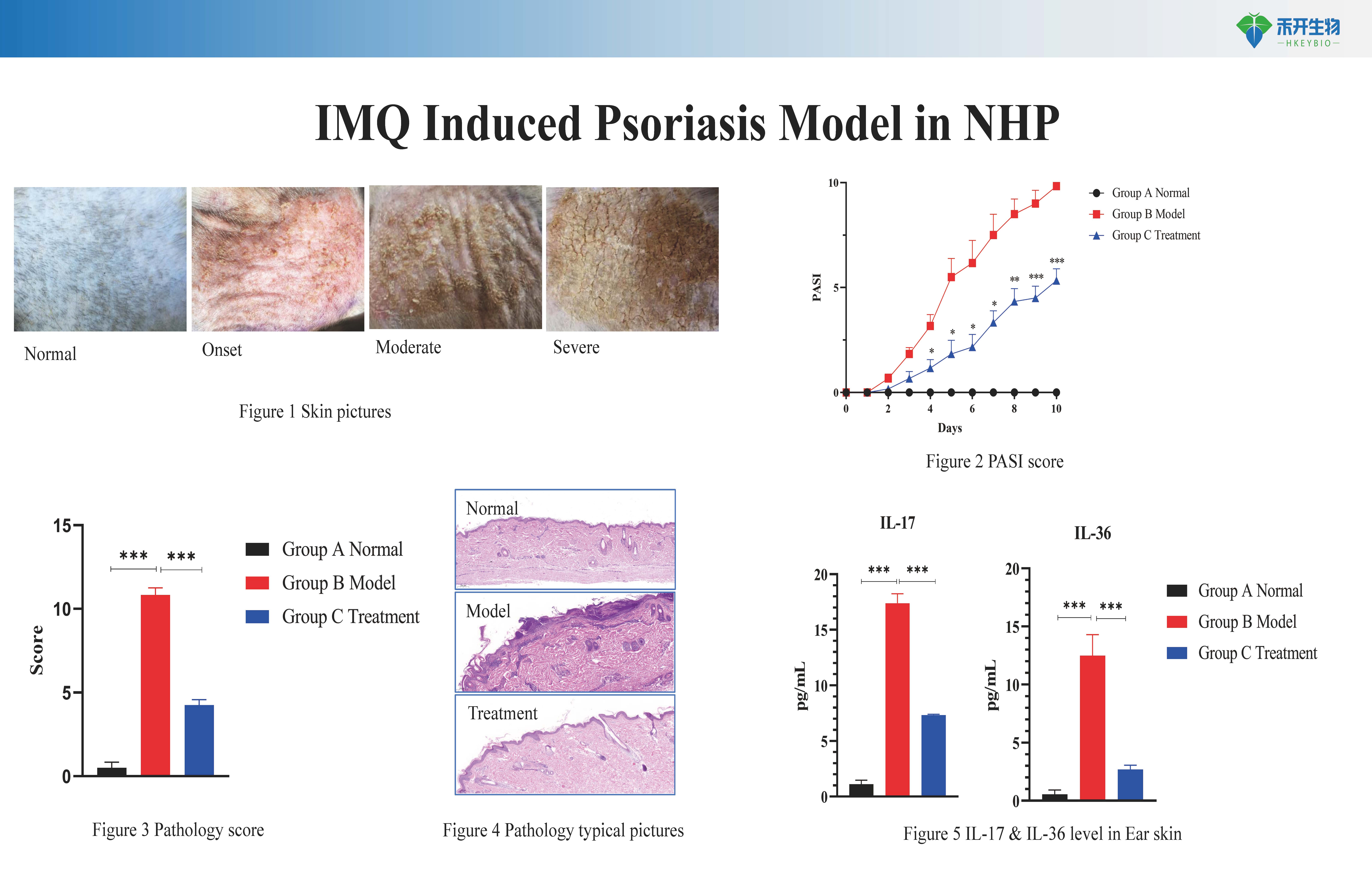 NHP 银屑病 Pso模型介绍-20230412_20240612103258
