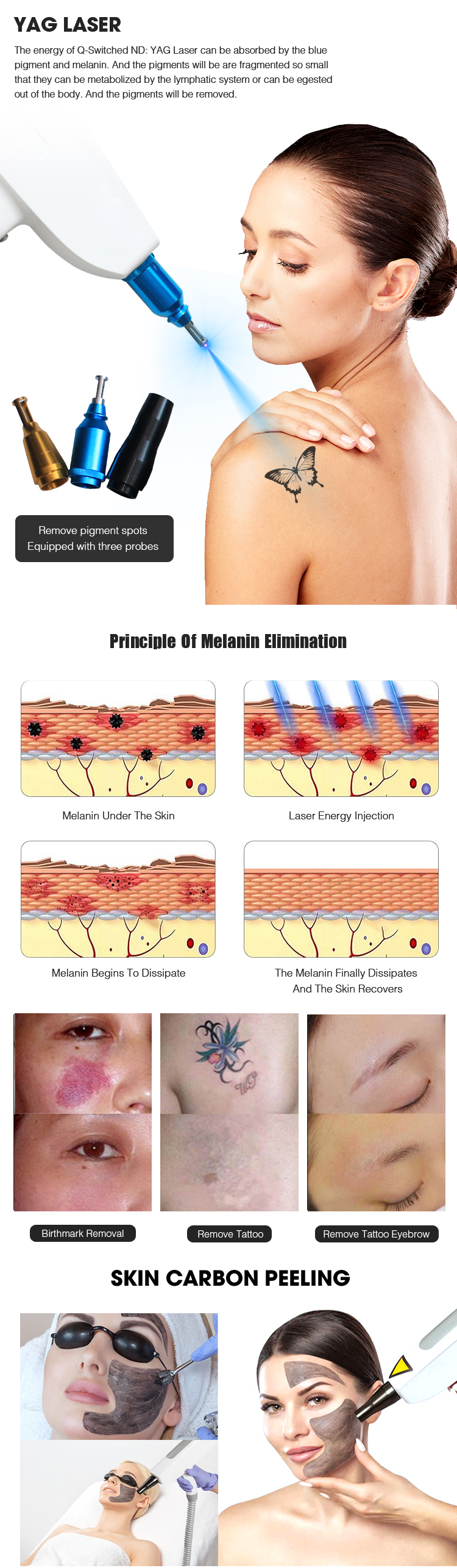 &Eacute;pilation IPL SHR