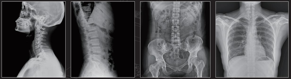 MCI0402 X Ray စက်ရုပ်ပုံ (၈)၊
