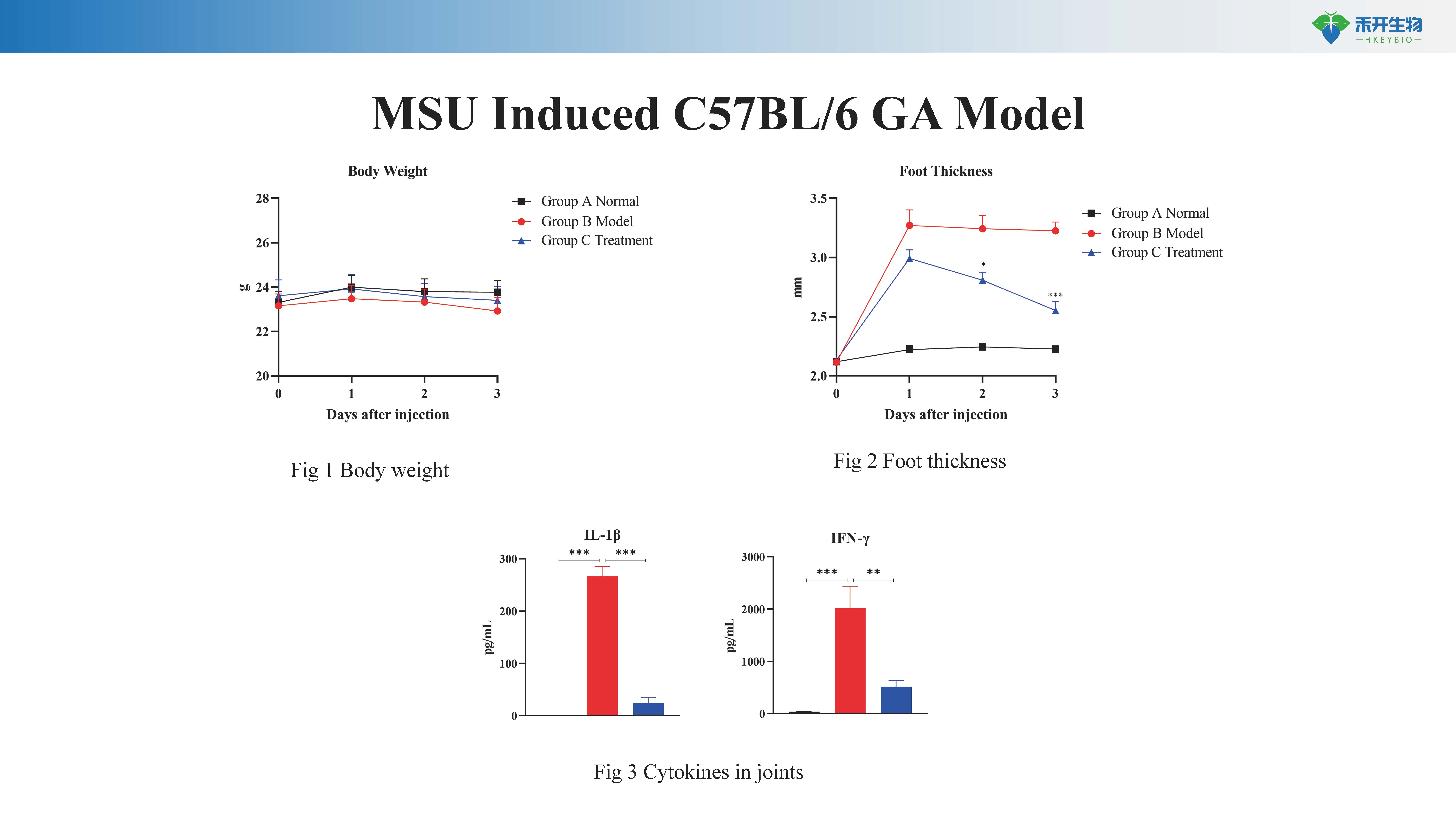 GA 模型介绍-20240417_20240613104342_页面_2 痛风性关节炎