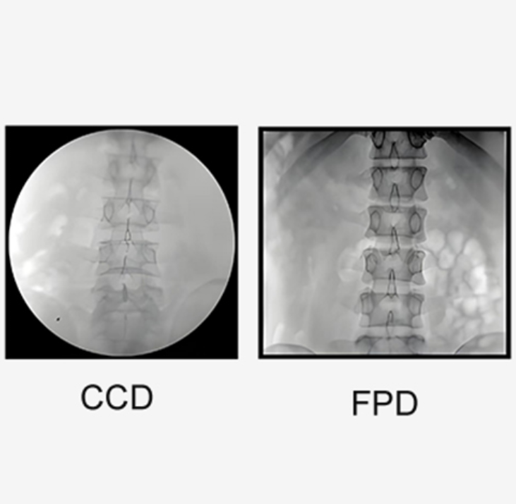 sistema con arco a C digitale(8)