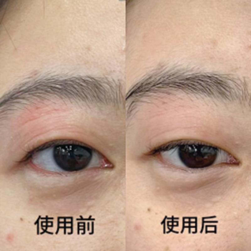 对比