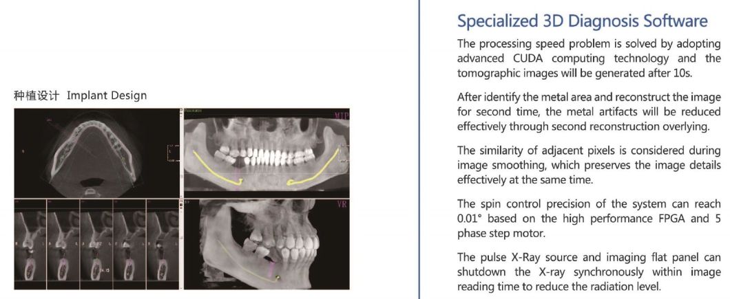 H-X9010dpro-2D-Digital-Panoramic-Dental-X-ray-Machine (5)