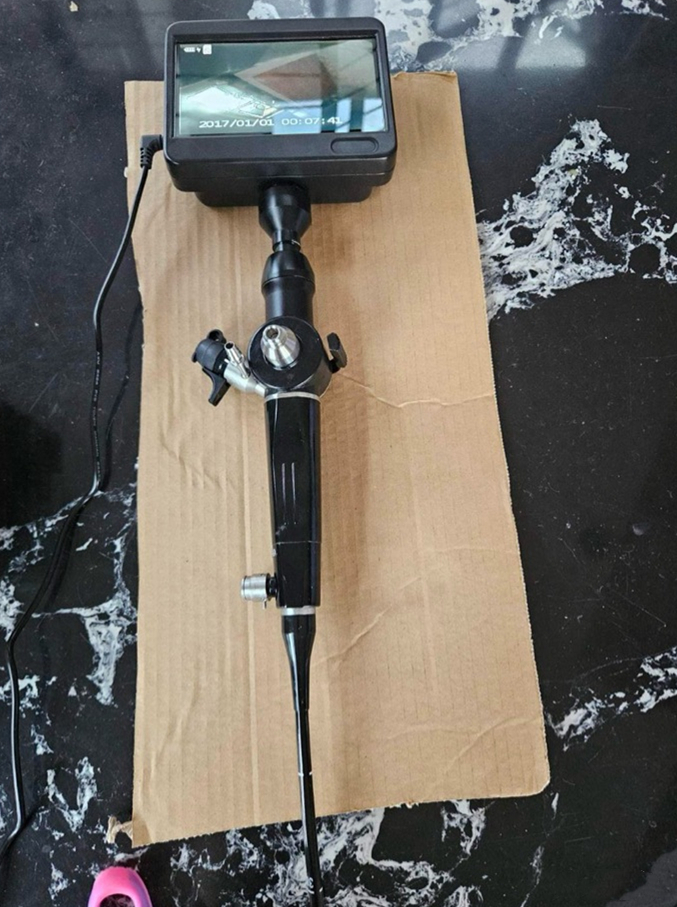 Isang video choledochoscope na nagpapakita ng real-time na endoscopic view sa high-definition na monitor nito.