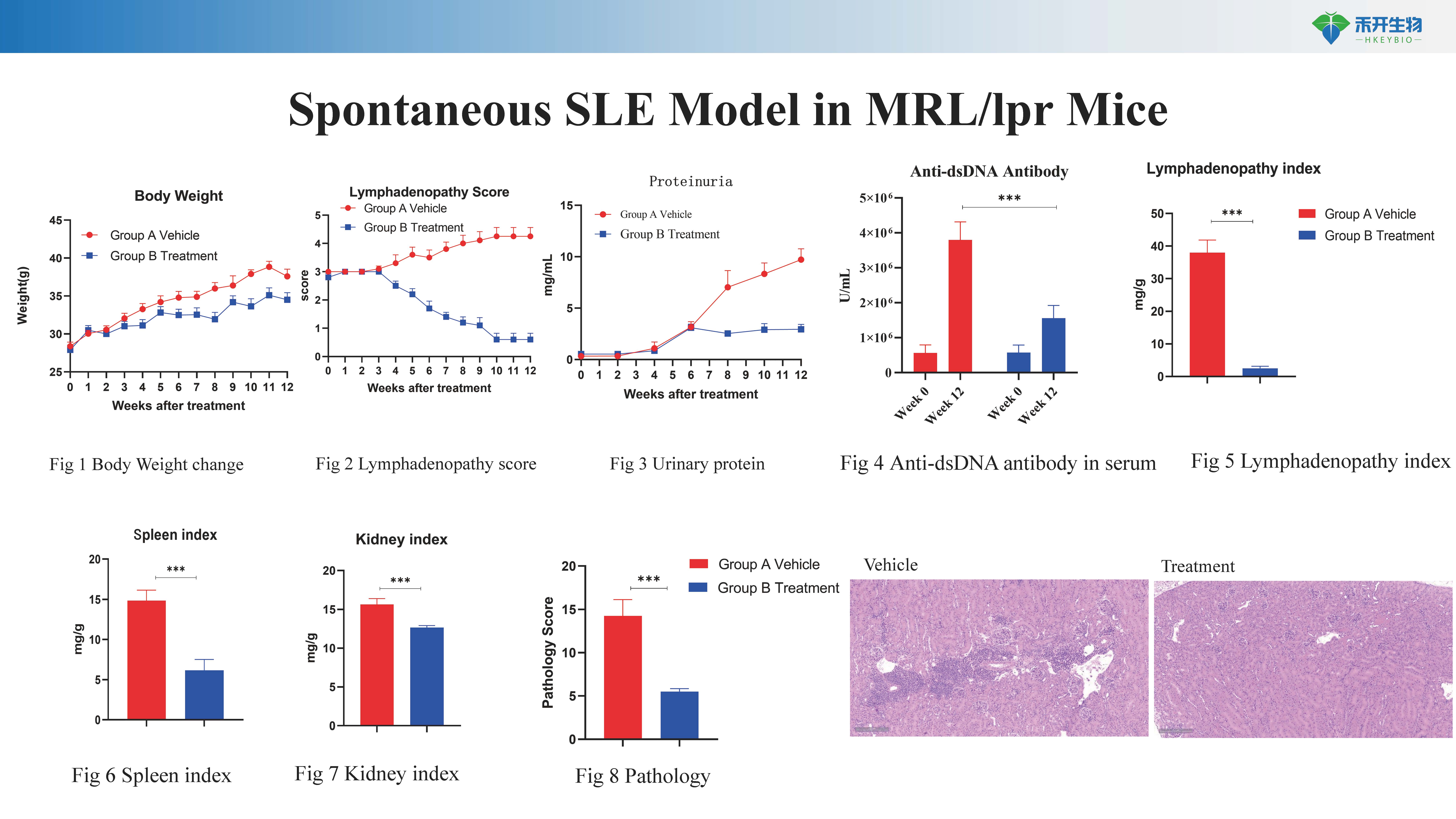 系统性红斑狼疮 SLE模型介绍 20240418_20240612141244_页面_1