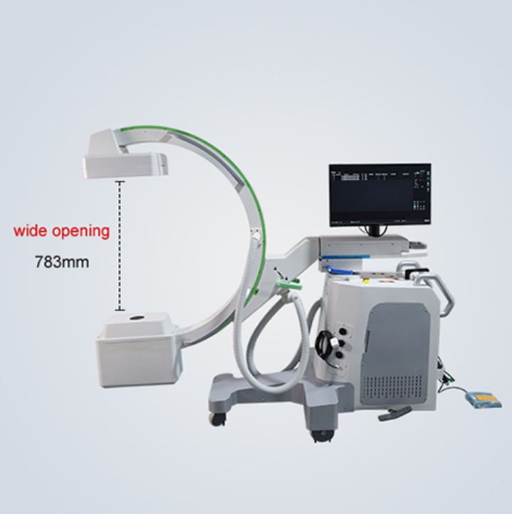 sistema con arco a C digitale(1)