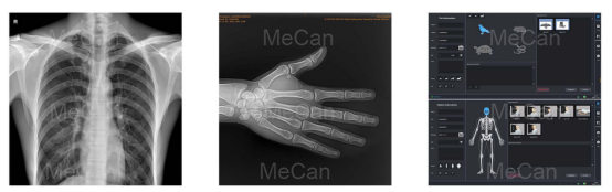 &Iacute;omh&aacute; t&aacute;st&aacute;la den Meais&iacute;n Soghluaiste DR X Ray