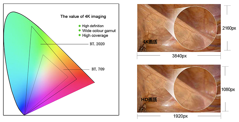 Sistema de c&aacute;mara endosc&oacute;pica 4K todo en uno HD-390