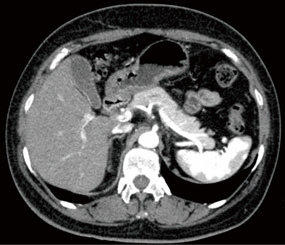 ct-scan-tradisyon&egrave;l-algorithm