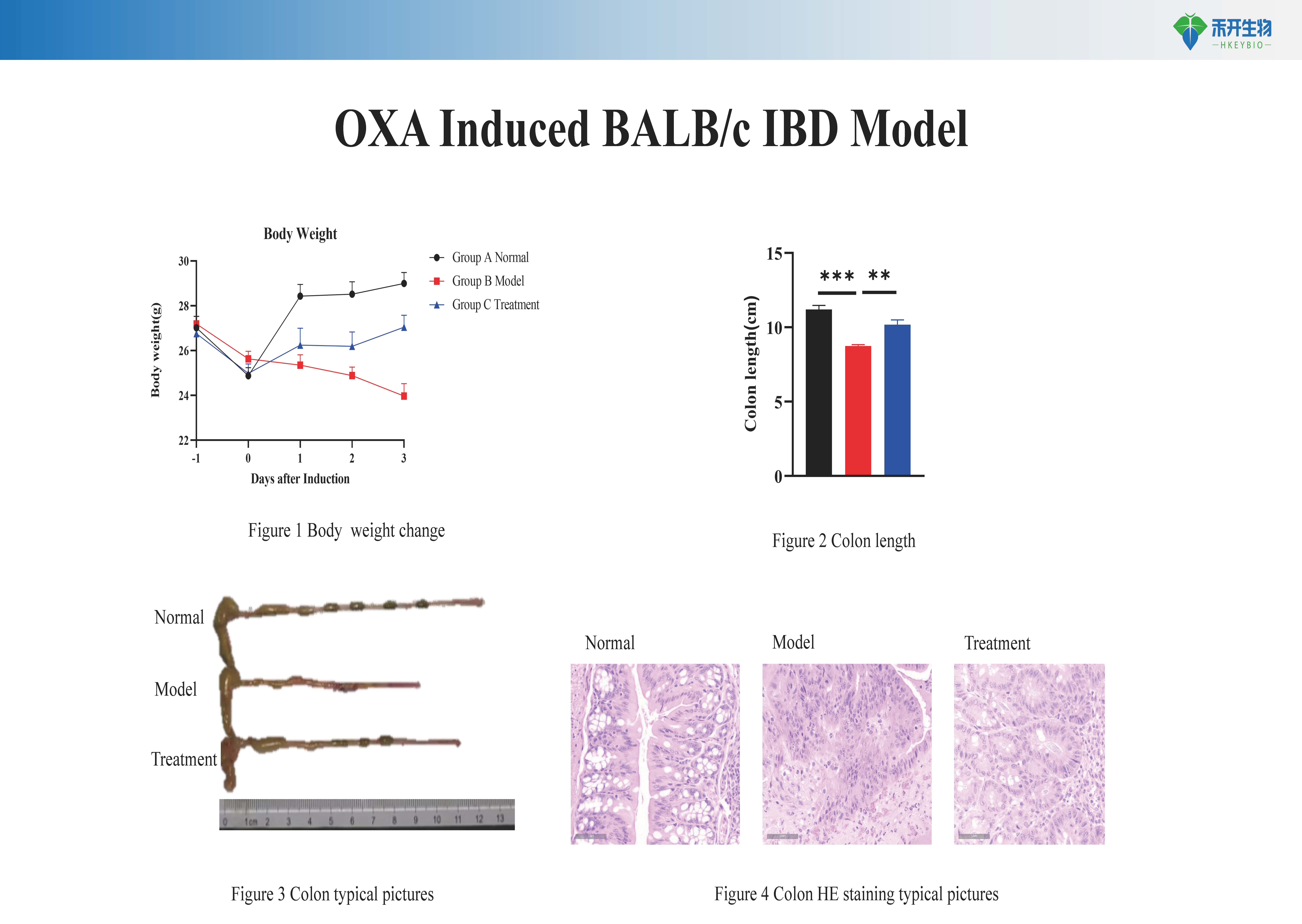 炎症性肠炎 IBD模型介绍 2024026_20240603150729