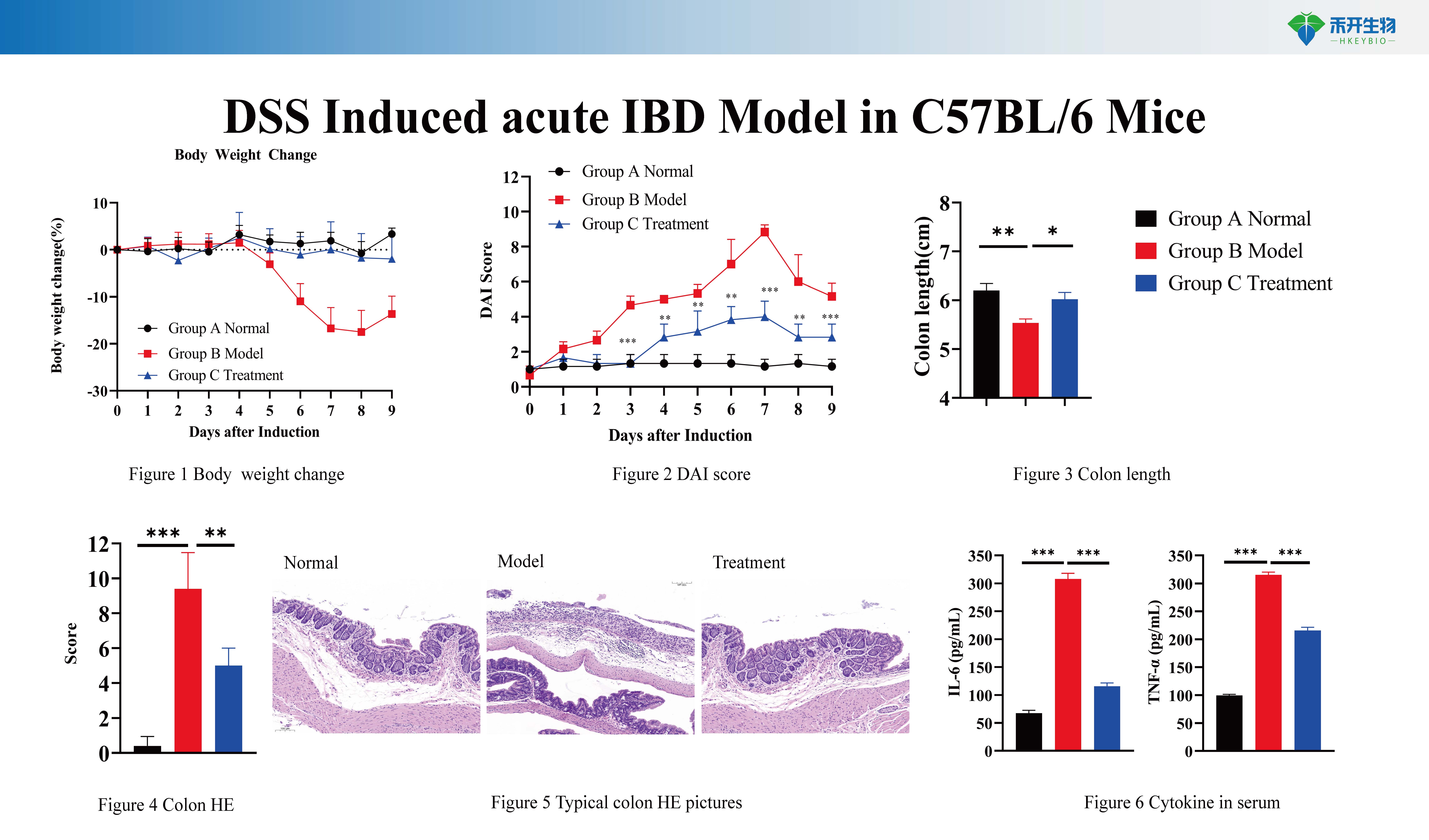 炎症性肠炎 IBD模型介绍 2024026_20240603150729_页面_1