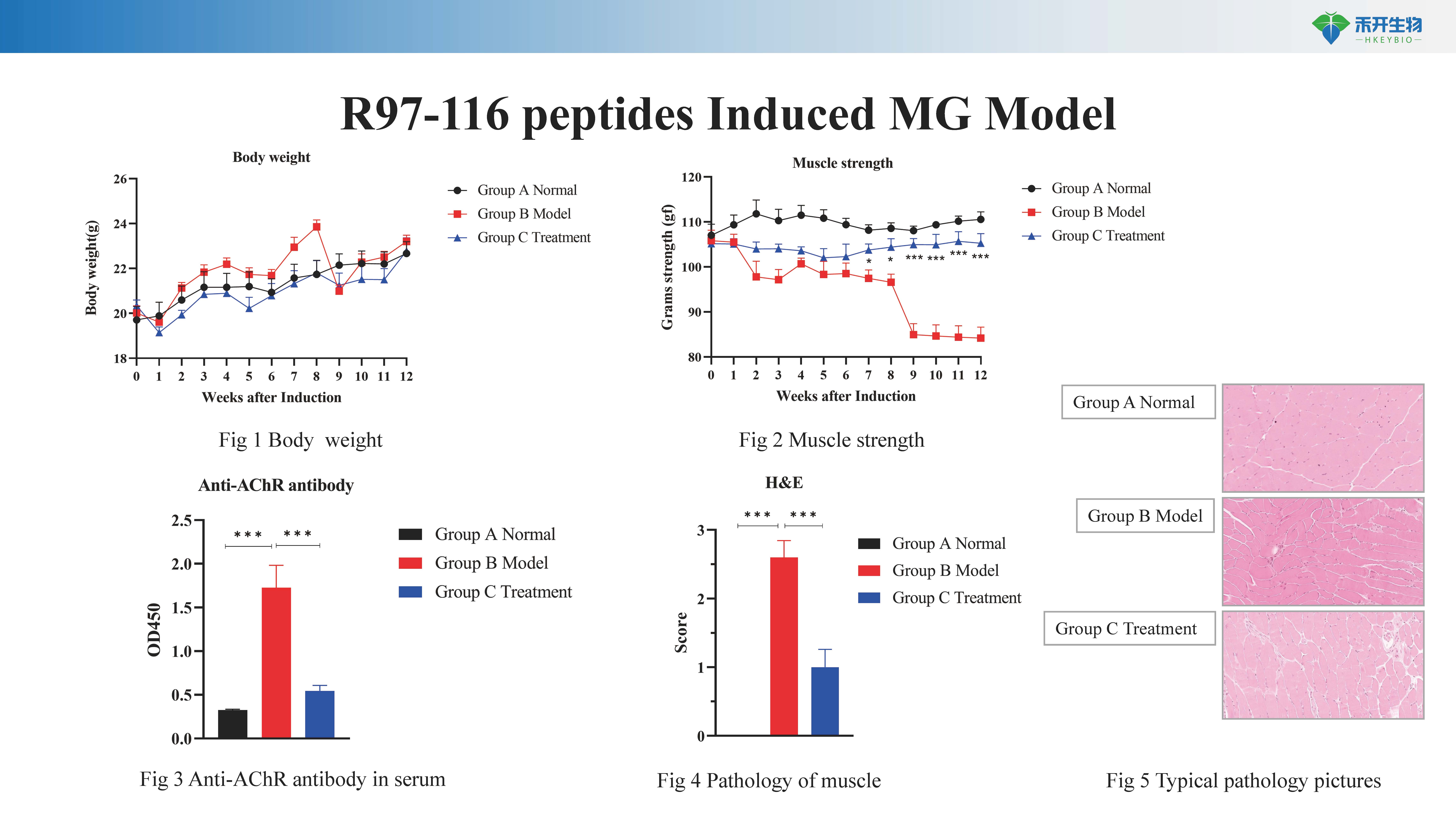 重症肌无力 MG模型介绍 20240204_20240613114124