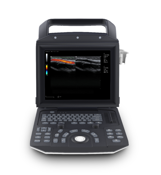 เครื่องสแกนอัลตราซาวนด์