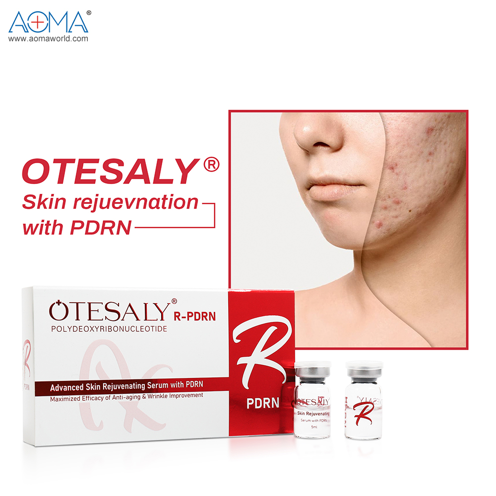 Skin Rejuvenation 5ml Pdrn Mesotherapy Aoma (10)