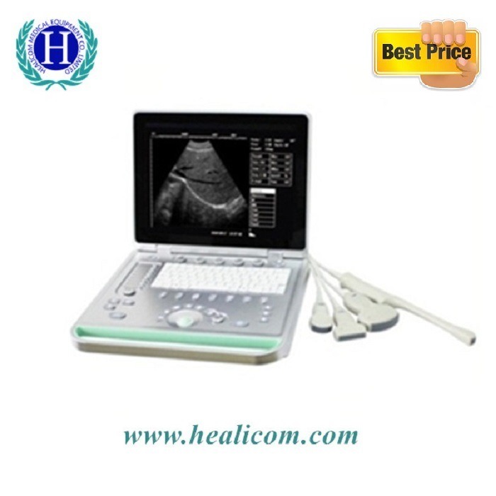 Hot-Sale-B-W-Portable-Ultsounounounounound-Scanner-Ultrasound-машина-с низкой ценой-1