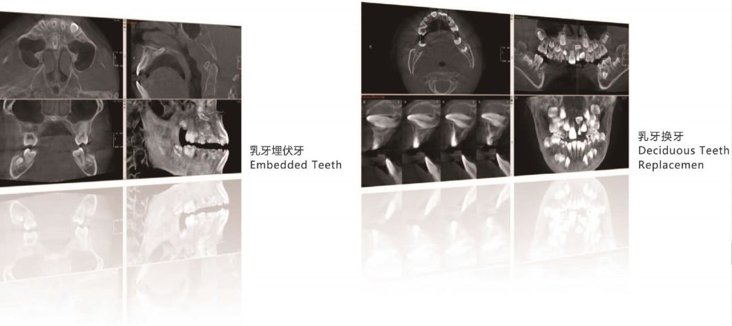 H-X9010dpro-2D-Digital-Panoramic-Dental-X-ray-Machine (6)