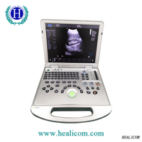 Ordinateur portable HUC-250 2D/3D / Scanner à ultrasons Doppler couleur portable