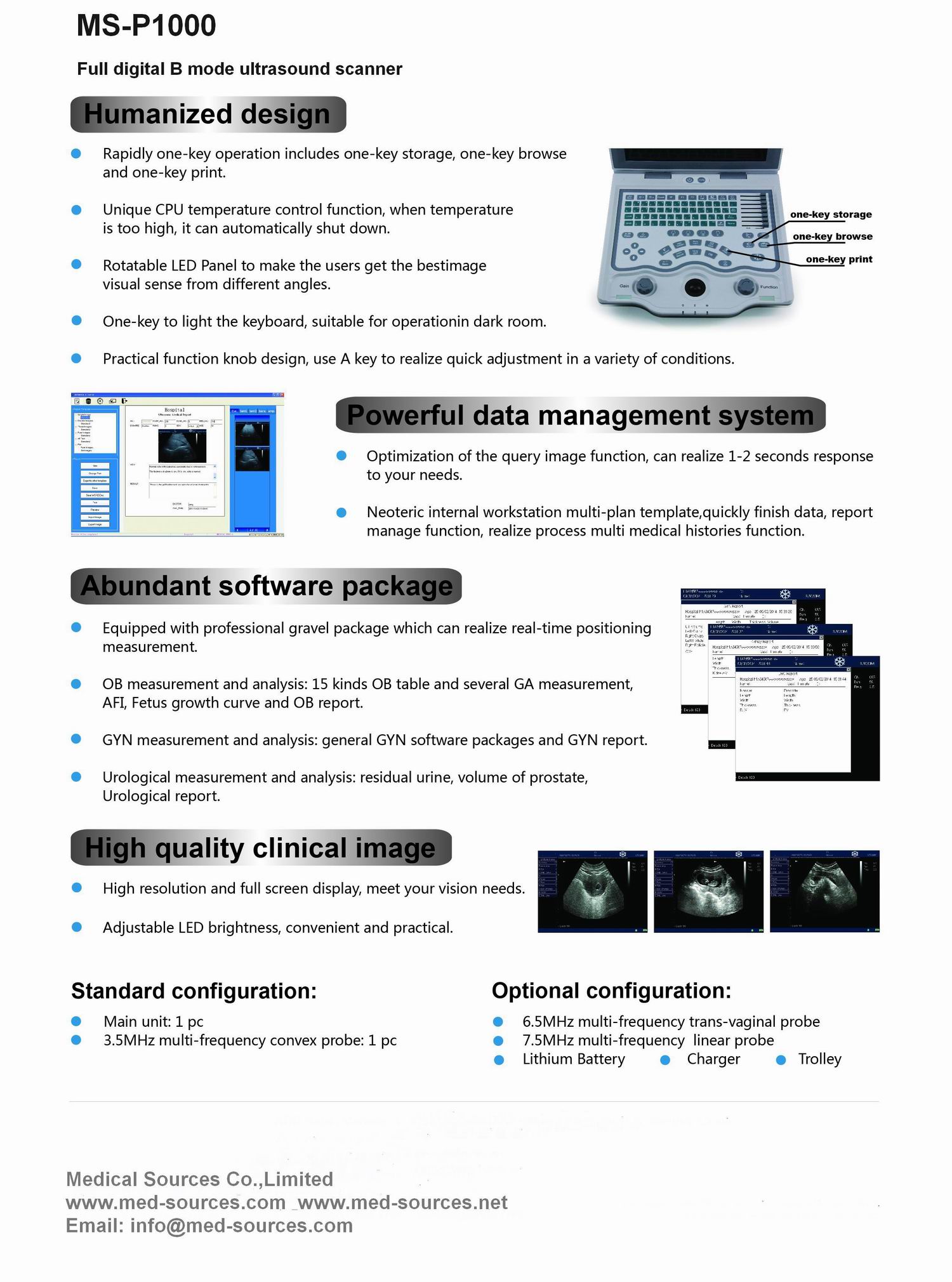MS-P1000 Digital Ultrasound Scanner-2