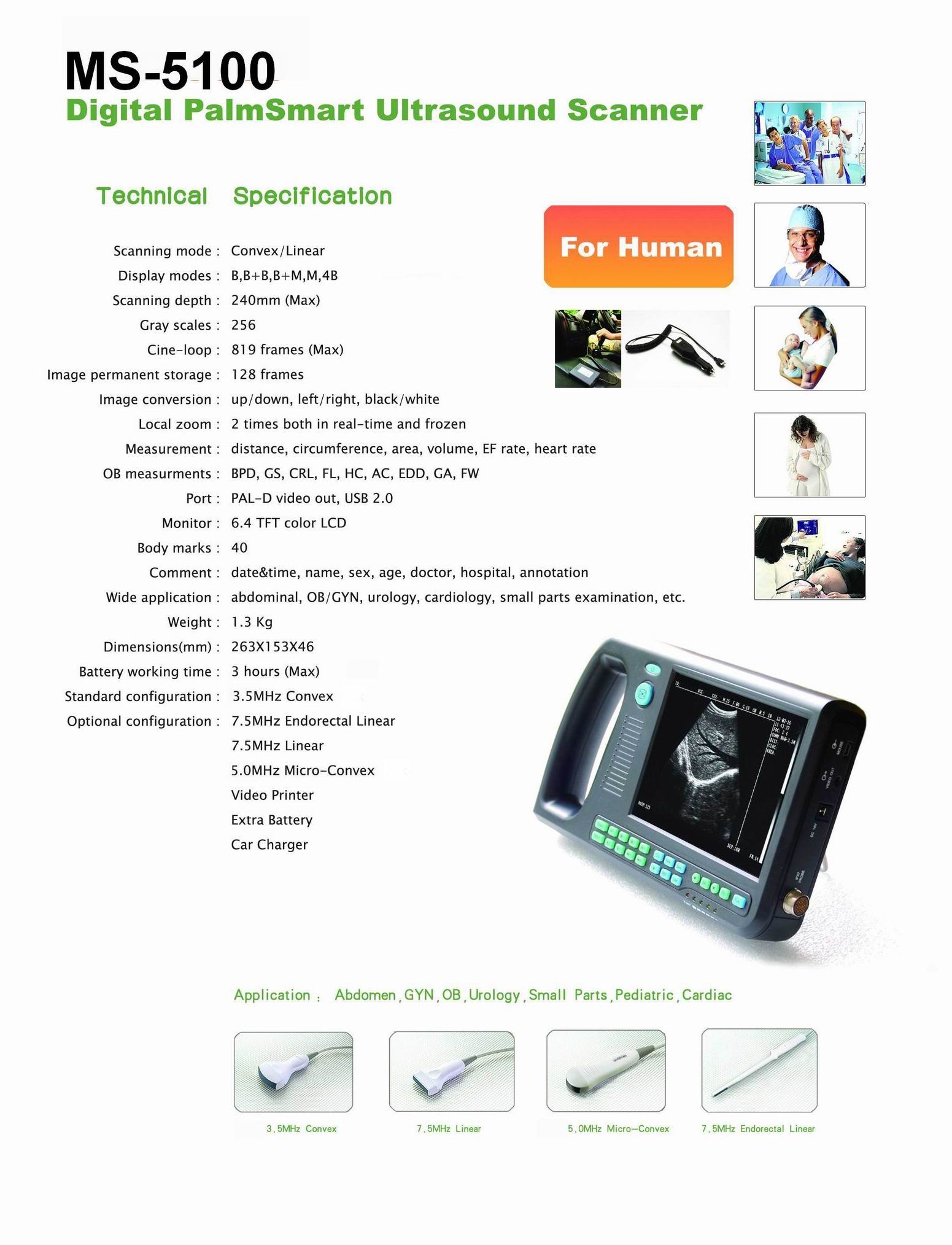 MS-5100 Digital Palm Ultrasound Scanner-2