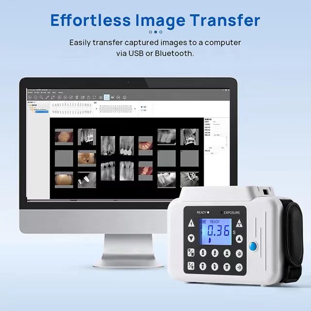 MS-D6800S Portable Dental X-ray Unit