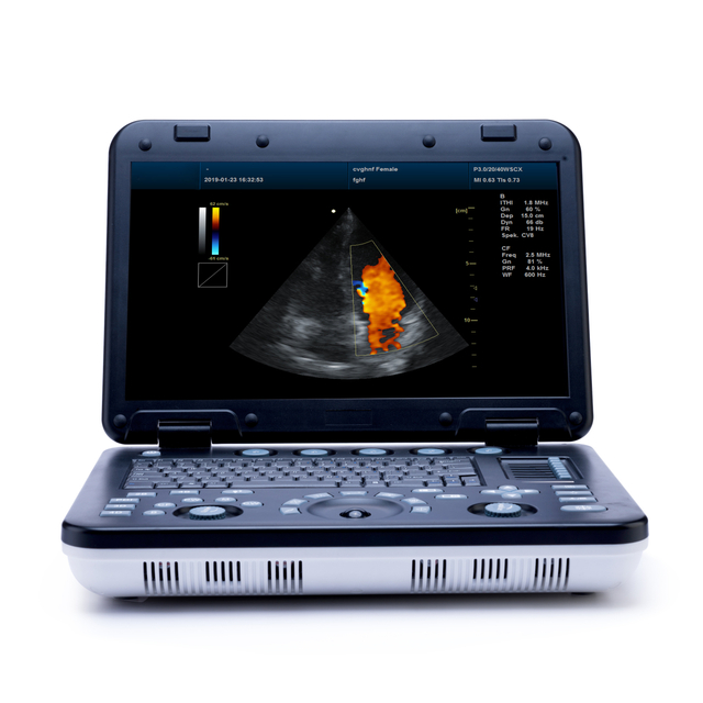 MS-C4000 3D 4D Color Doppler Ultrasound Scanner