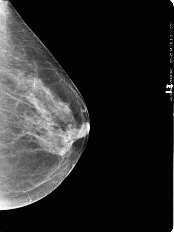 MS-M8500 Mammography System