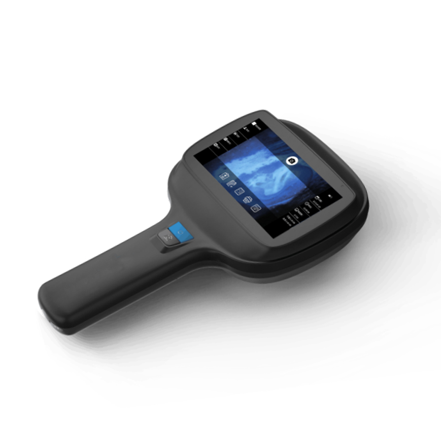 MS-WD1000 Dermatoscope