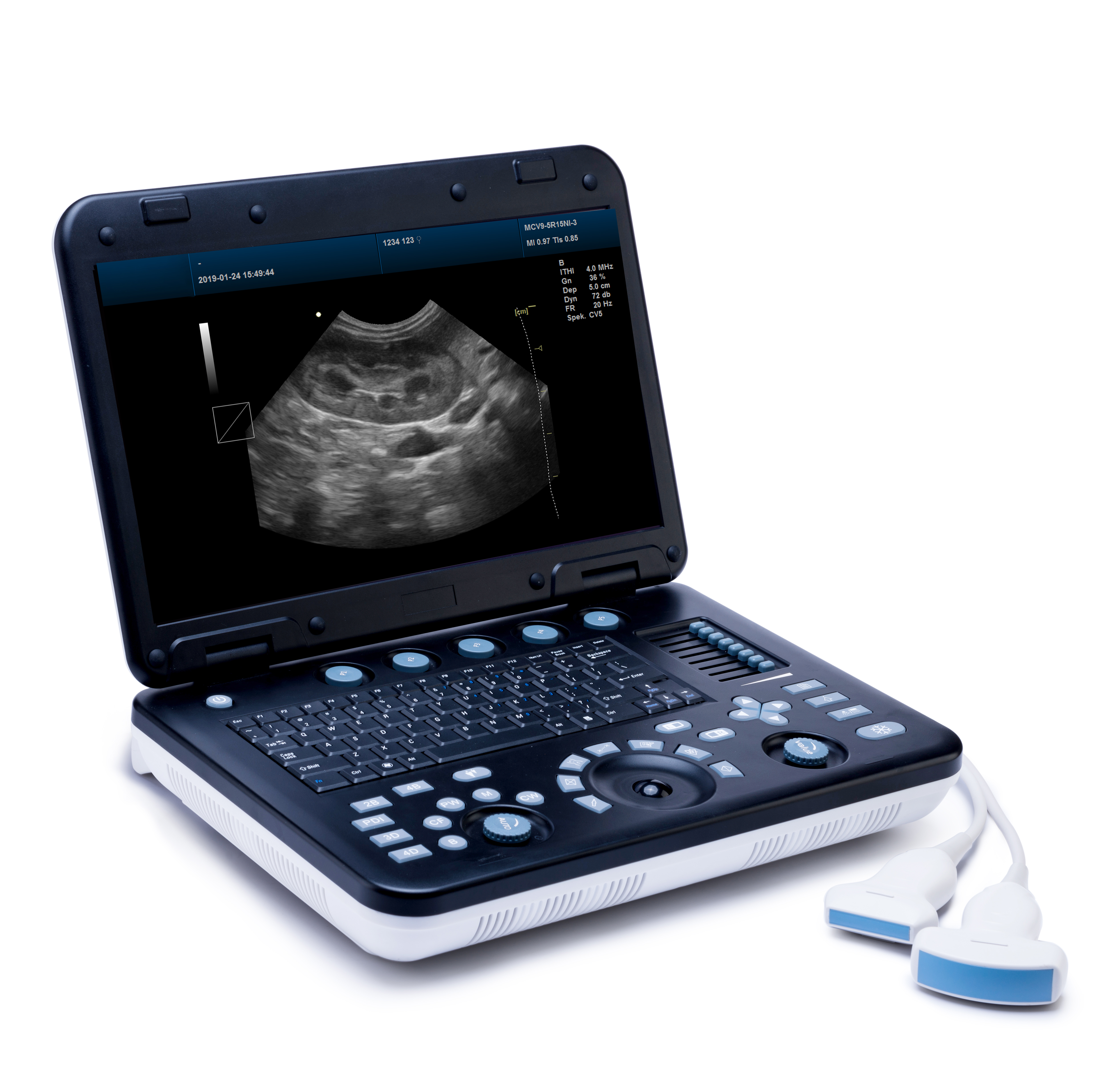 MS-C4000 3D 4D Color Doppler Ultrasound Scanner
