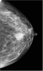 MS-M8300 Mammography System