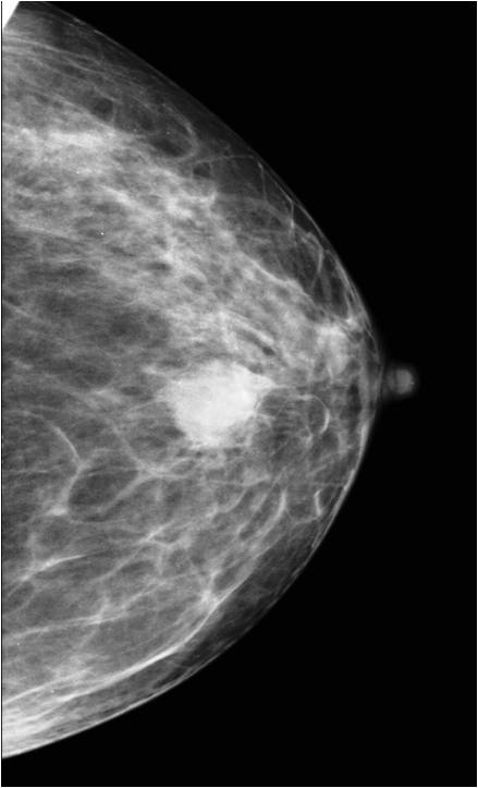 MS-M8300 Mammography System