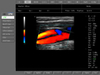 (MS-C6500) Hospital Trolley Colour Doppler Ultrasound Scanner