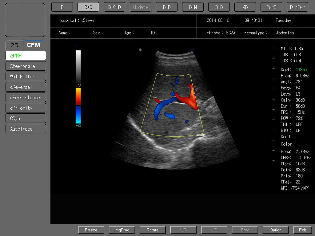 MS-C6600 Colour Doppler Ultrasound Scanner
