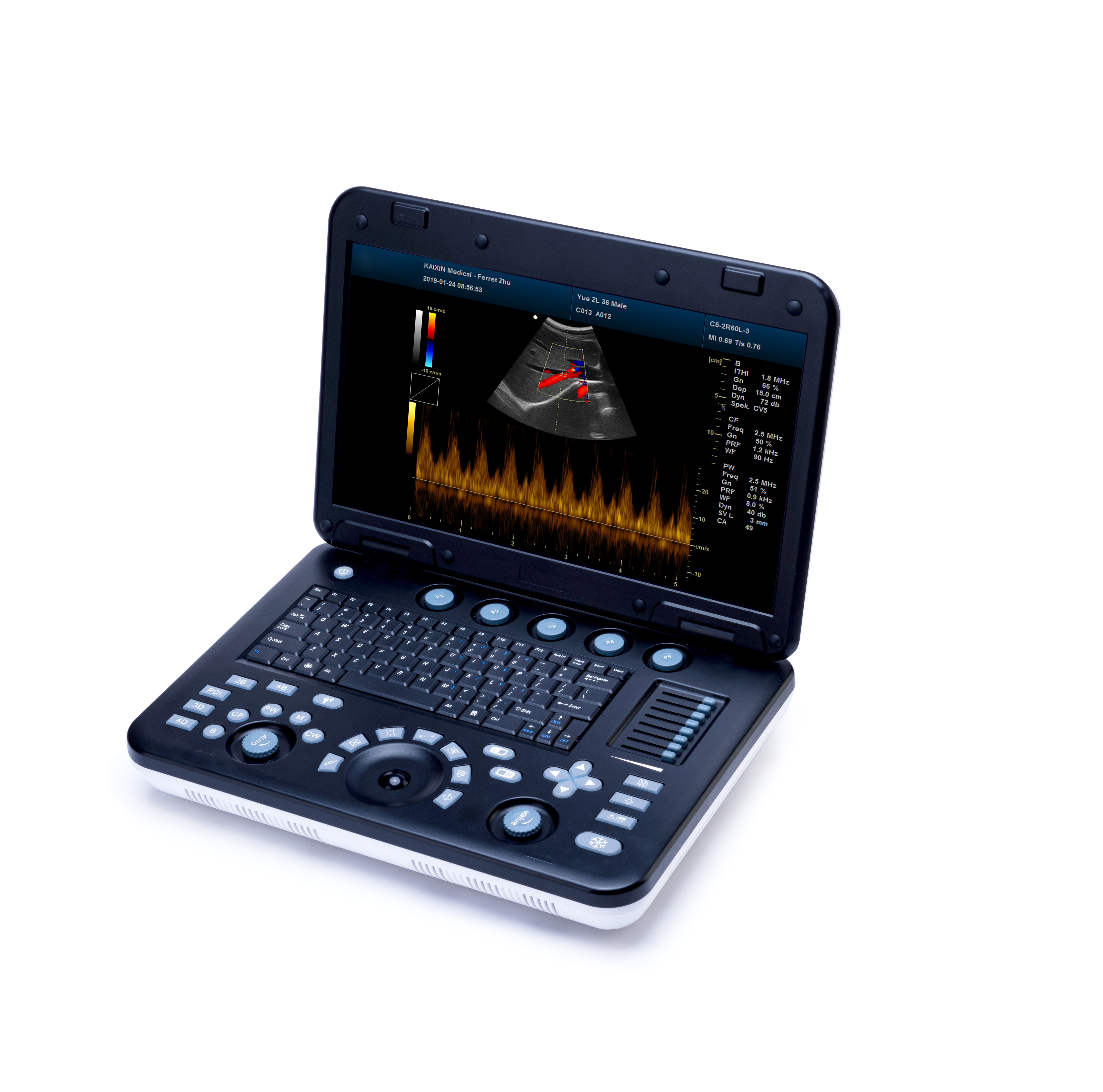 MS-C4000 3D 4D Color Doppler Ultrasound Scanner