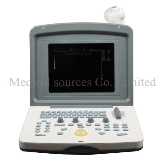 (MS-P800) Scanner à ultrasons Doppler portable pour équipement hospitalier pas cher